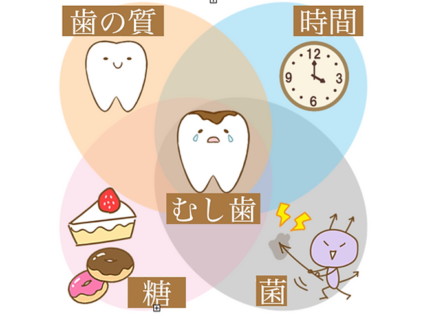 虫歯の原因