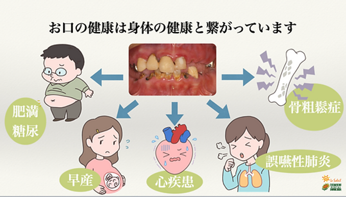 お口の健康は体の健康とつながっています