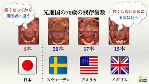 先進国の70歳の残存歯数