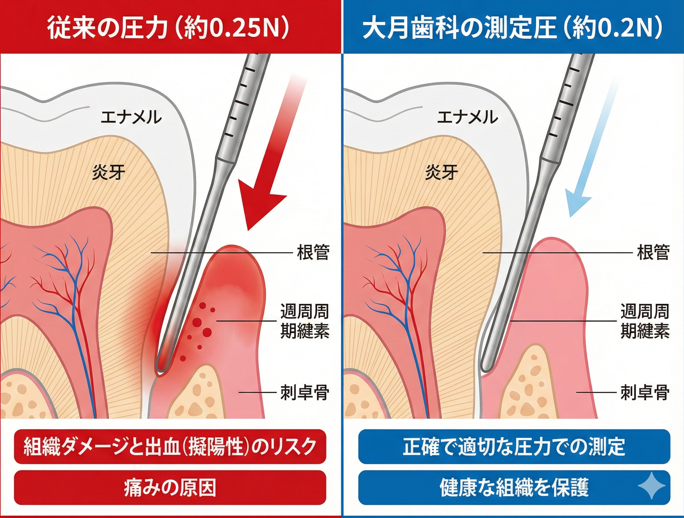 0.2Nと従来圧の比較図解